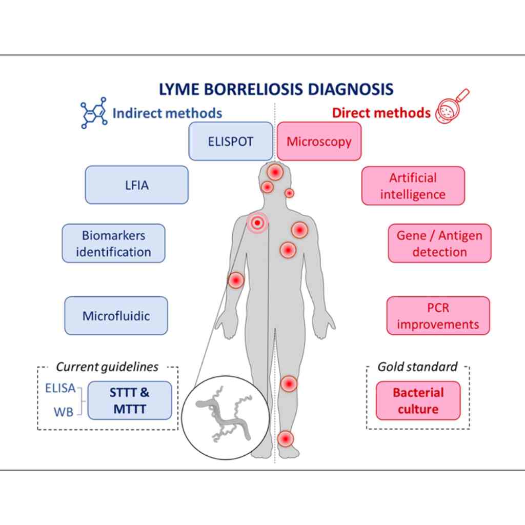 Diagnostic De La Borréliose De Lyme : état Des Lieux Des Améliorations ...